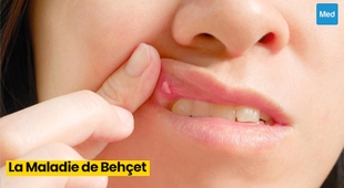 المجلة الطبية La Maladie de Behçet