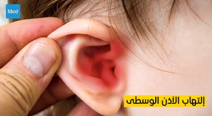 Magazine التهاب الأذن الوسطى