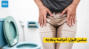 Magazine سلس البول: أعراضه وعلاجه