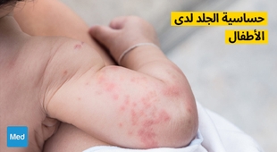 Magazine حساسية الجلد لدى الأطفال