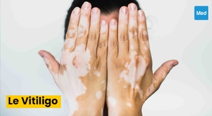 Magazine Vitiligo : tout ce que vous devez savoir