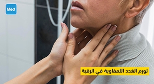 Magazine تورم الغدد اللمفاوية في الرقبة