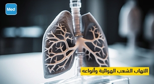 Makaleler التهاب الشعب الهوائية وأنواعه