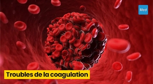 Makaleler Troubles de la coagulation