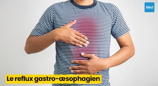 Makaleler Reflux gastro-œsophagien (RGO) : causes, symptômes et traitement