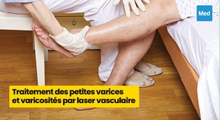 Magazine Traitement des petites varices et varicosités par laser vasculaire