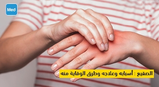 Magazine الصقيع : أسبابه وعلاجه وطرق الوقاية منه