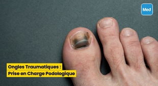 Magazine Ongles Traumatiques : Prise en Charge Podologique