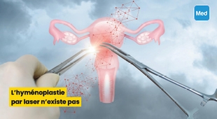 Makaleler L’hyménoplastie par laser n’existe pas