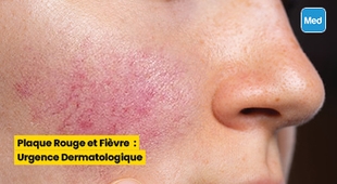 Magazine Plaque Rouge et Fièvre : Urgence Dermatologique 