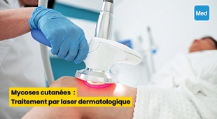 Magazine Mycoses cutanées : Traitement par laser dermatologique