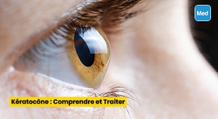 Magazine Kératocône : Comprendre et Traiter