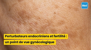 Makaleler Taches brunes et mélasma : causes, symptômes et traitements