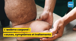 Makaleler  L’œdème corporel : causes, symptômes et traitements 