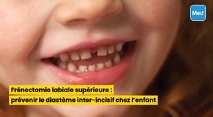Magazine Frénectomie labiale supérieure  prévenir le diastème chez l'enfant