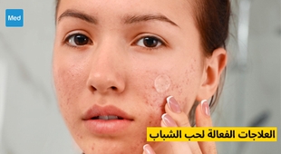 Magazine العلاجات الفعالة لحب الشباب