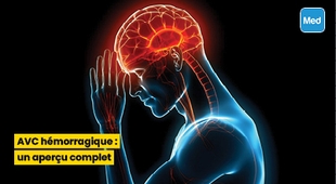 Magazine AVC hémorragique : un aperçu complet