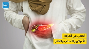 Magazine الحصى في المرارة : الأعراض والأسباب والعلاج