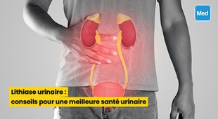 Makaleler Lithiase urinaire : conseils pour une meilleure santé urinaire