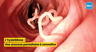 Makaleler L'hydatidose : Une zoonose parasitaire à connaître