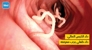 Makaleler داء الكيس المائي: داء طفلي يجب معرفته