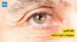 Magazine ظفر العين: معلومات طبية شاملة