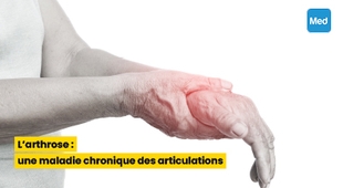 Magazine L'arthrose : une maladie chronique des articulations