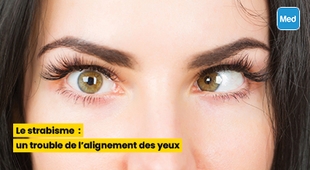 Makaleler Le strabisme : un trouble de l'alignement des yeux