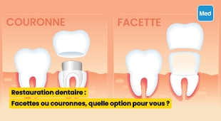 Magazine Restauration dentaire : Facettes ou couronnes, quelle option pour vous ?