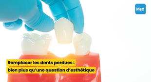 Magazine Remplacer les dents perdues : bien plus qu'une question d'esthétique