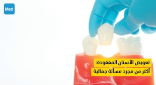 Magazine تعويض الأسنان المفقودة : أكثر من مجرد مسألة جمالية