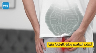 Magazine أسباب البواسير وطرق الوقاية منها