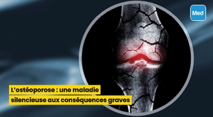 Magazine L'ostéoporose : une maladie silencieuse aux conséquences graves
