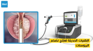 Magazine التقنيات الحديثة لعلاج تضخم البروستات