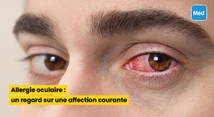 Magazine Allergie oculaire : un regard sur une affection courante