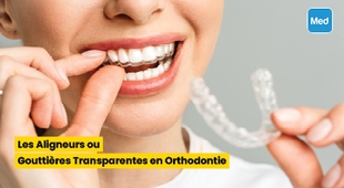 Makaleler Les Aligneurs ou Gouttières Transparentes en Orthodontie