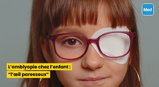 Makaleler L'amblyopie chez l'enfant : l'œil paresseux
