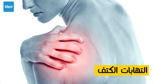 Makaleler التهابات الكتف 