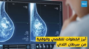 Makaleler أبرز الخطوات  للتقصي والوقاية من سرطان الثدي