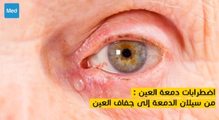 Makaleler اضطرابات دمعة العين : من سيلان الدمعة إلى جفاف العين