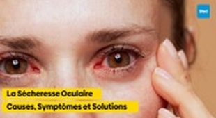 Makaleler La Sécheresse Oculaire : Causes, Symptômes et Solutions