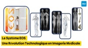 Makaleler Le Système EOS : Une Révolution Technologique en Imagerie Médicale