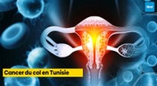 Magazine Cancer du col en Tunisie