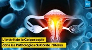 Makaleler L'Intérêt de la Colposcopie dans les Pathologies du Col de l'Utérus
