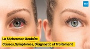 Magazine La Sécheresse Oculaire : Causes, Symptômes, Diagnostic et Traitement