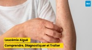 Makaleler Leucémie Aiguë : Comprendre, Diagnostiquer et Traiter