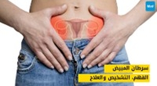 Makaleler سرطان المبيض: الفهم، التشخيص والعلاج