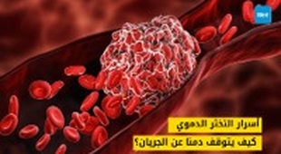 Makaleler أسرار التخثر الدموي: كيف يتوقف دمنا عن الجريان