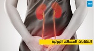 Makaleler التهابات المسالك البولية