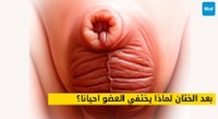 Magazine بعد الختان لماذا يختفي العضو احيانا؟